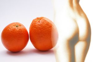 Orangenhaut und was dagegen hilft